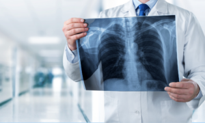 von Künstlicher Intelligenz bedrohte akademische Berufe